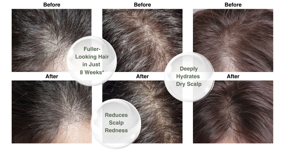 Miyaki Anti Aging Hair Tonic Hair Result