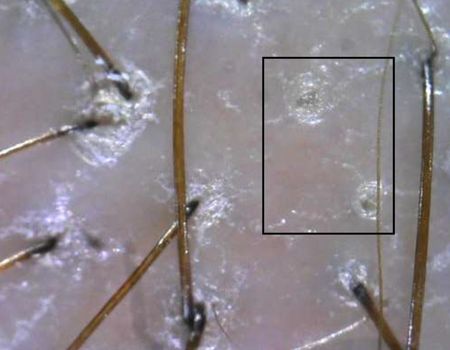 Slow cells regeneration