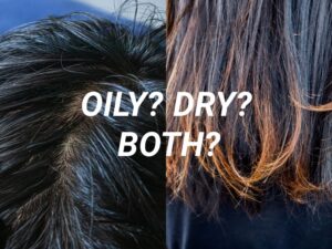 Dry Hair VS Oily Hair VS Both..