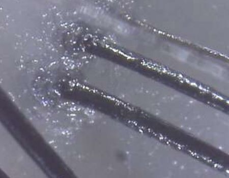 Scalp Problems - Oily Scalp