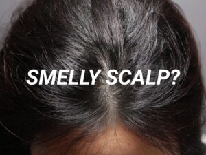 Smelly Scalp