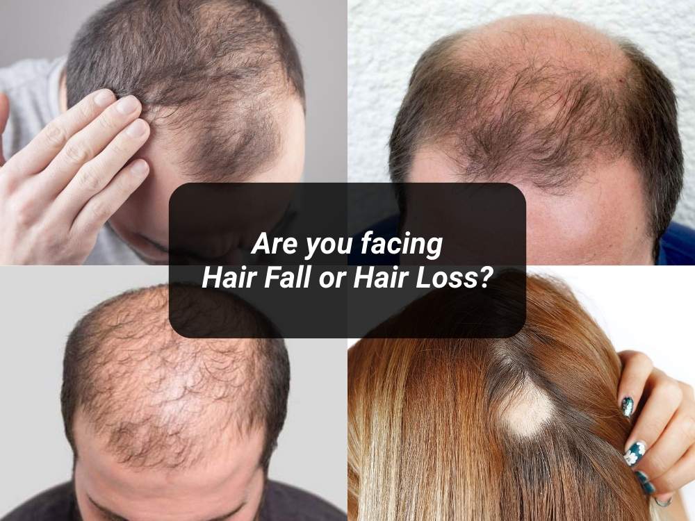 Hair Loss? Hair Fall?